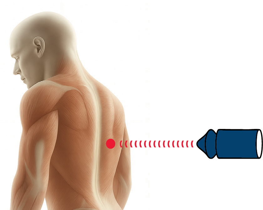 Point focused shockwaves
