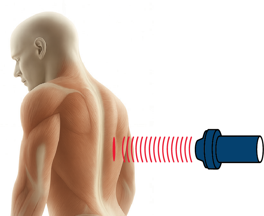 Linear Shockwave Technology (LSWT)